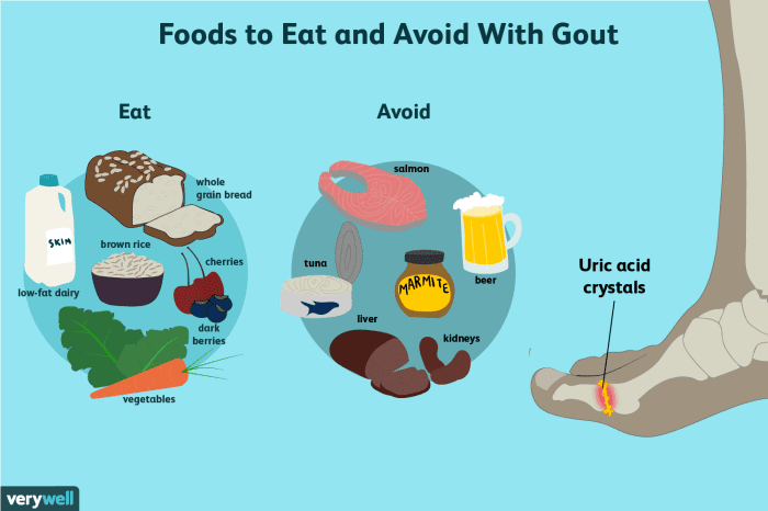 Gout diet