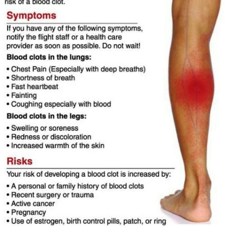 Symptoms of blood clot in leg