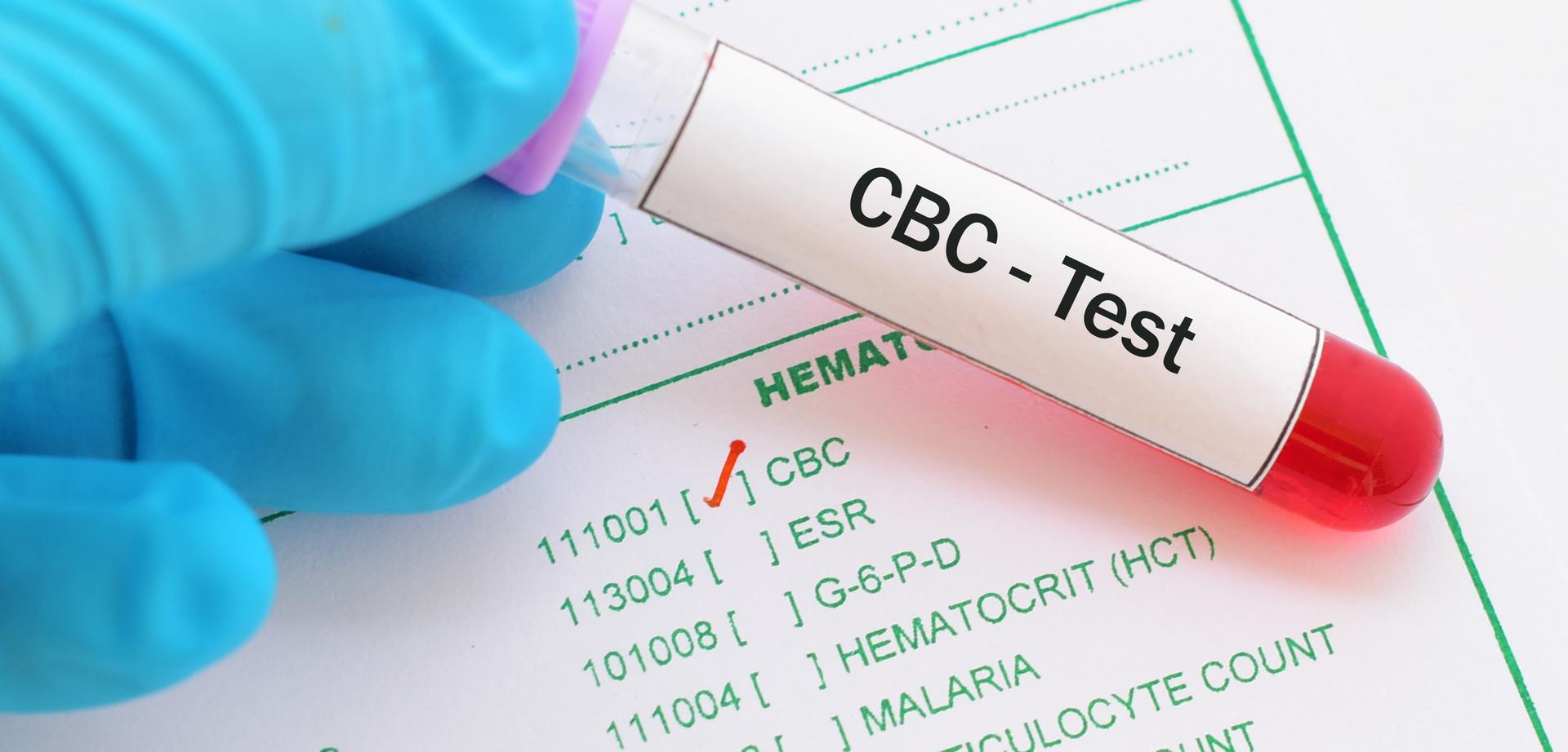 Cbc blood test