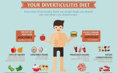 Diverticulitis Diet: A Comprehensive Guide to Manage Your Condition