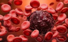 Blood Cancer: A Comprehensive Guide to Causes, Symptoms, and Treatment