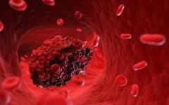 Blood Clots: An Overview, Diagnosis, and Treatment