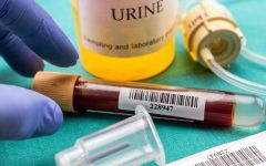 Blood in Urine: A Comprehensive Guide to Understanding and Managing Hematuria