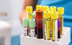 CMP Blood Test: A Comprehensive Metabolic Panel for Health Assessment